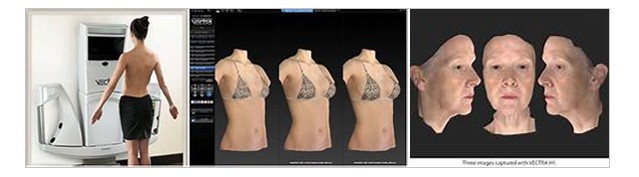 Photographie Vectra 3D de la chirurgie plastique